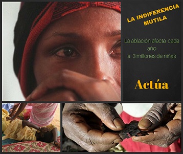 no m�s a la ablaci�n